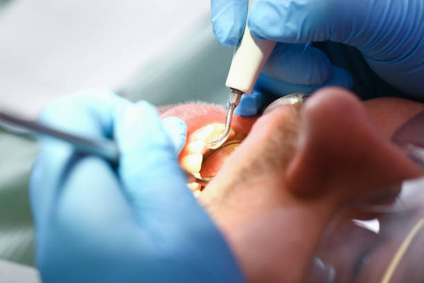 Best Emergency Dental Care for Trauma or Injury in Cashion, OK