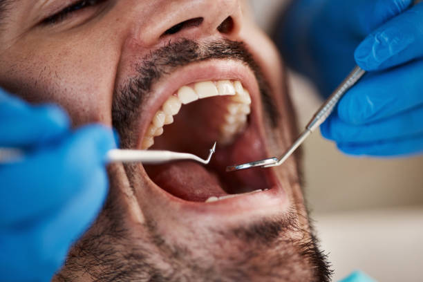 Best Same-Day Emergency Dentist in Cashion, OK