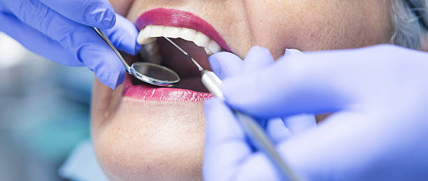 Best Emergency Tooth Extraction in Cashion, OK