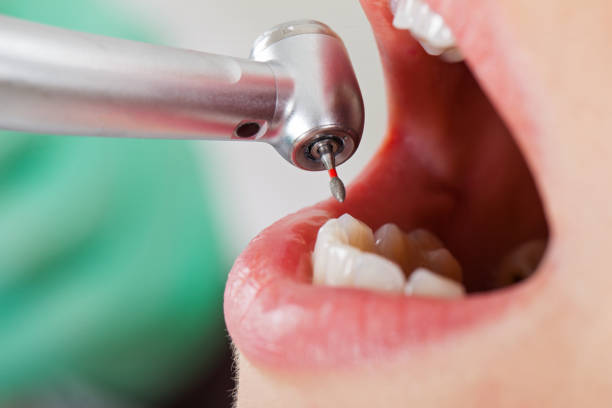 Best Urgent Dental Care in Cashion, OK